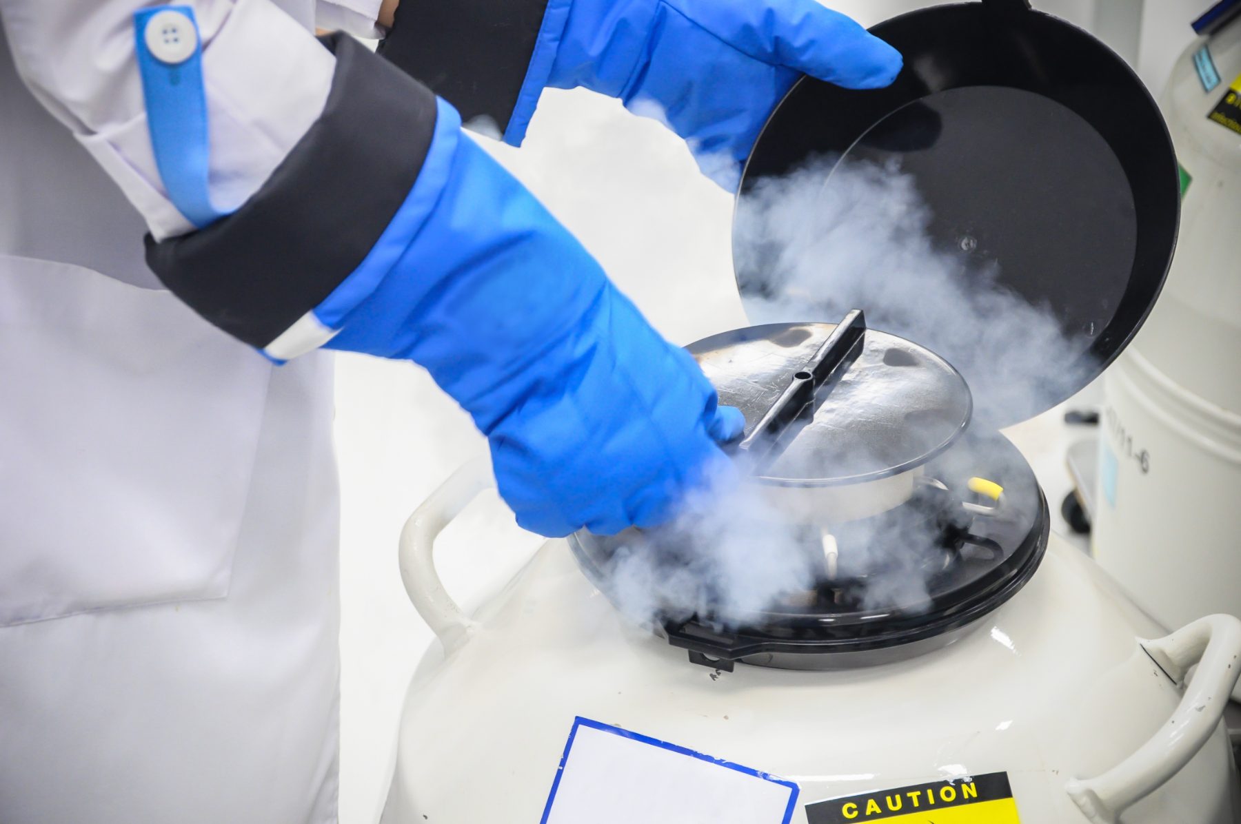 Cryogene opslag bij HairSafe